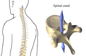 spinal_canal.111134841_std